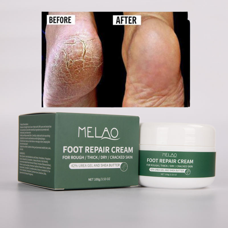 Crème pieds pour talons gercés secs