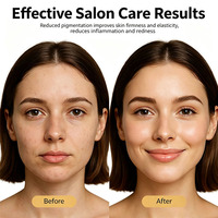 Masque LED en silicone ZKM 4 couleurs pour le visage et le cou, masque de soin à la lumière LED PDT Photon, appareil de beauté pour le soin de la peau à domicile ou en salon, prise en charge de la personnalisation OEM