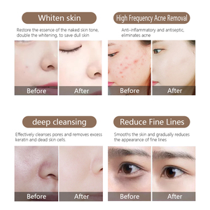 Equipo de Spa de Belleza Hydra 9 en 1, Limpieza Facial de Poros, Reafirmación de la Piel, Eliminación de Arrugas, Lifting Facial en V, Máquina de Hidrodermoabrasión - Product Image 4