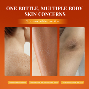 Spray exfoliant corporel à l'acide kojique et au curcuma pour le soin de la kératine, solution exfoliante douce pour éclaircir et unifier le teint - Product Image 3