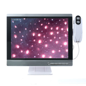 ماسح فروة الرأس اللاسلكي كاميرا HD الشعر بصيلات الشعر لالتقاط الصور وتحليل الفيديو - Product Image 4