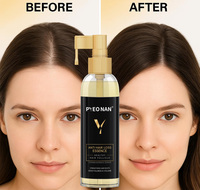 Sérum de traitement pour la croissance rapide des cheveux pour femmes et hommes, huile anti-chute de cheveux, sérum de repousse à base de plantes, marque privée, huile de biotine