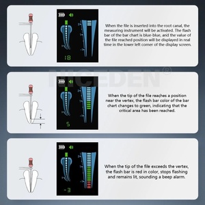 Instrumento de Medición de Longitud de Conducto Radicular Dental, Localizador de Ápice, Pantalla Grande, Monitoreo Dinámico en Tiempo Real, Dispositivo Endodóntico - Product Image 6