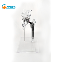 Modèle transparent d'implant de joint de hanche, modèle de remplacement, taille mini, modèle de présentation générique transparent