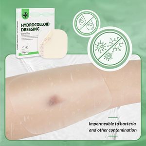hydrocolloid dressing for burns Hydrocolloid Healing: That White Gel Bubble - Blister Prevention main image 0