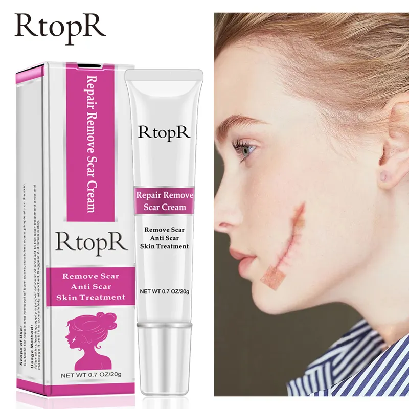 RtopR Acne Cicatrice Smagliature Crema di Rimozione di Riparazione Della Pelle Crema Per il Viso Acne Macchie Trattamento Dell'acne di Comedone Sbiancamento Crema di Cura Della Pelle