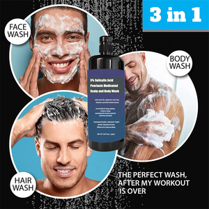 Ácido salicólico <span class=keywords><strong>para</strong></span> Psoriasis, <span class=keywords><strong>Dermatitis</strong></span> seborreica con aceite de zanahoria y <span class=keywords><strong>Aloe</strong></span>, tratamiento <span class=keywords><strong>para</strong></span> el cuero cabelludo y el cuerpo, alivio de la Psoriasis, caspa, 5% - Product Image 2