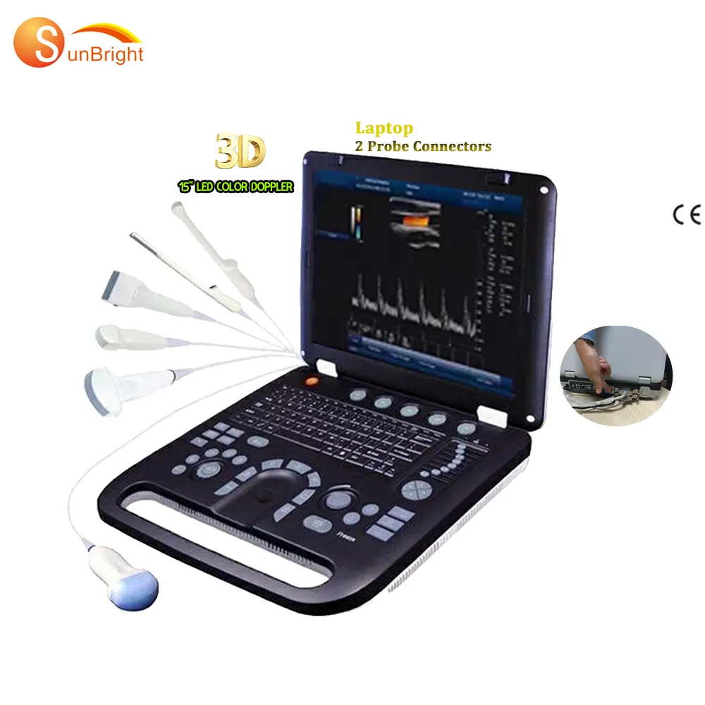 Beste Fabrikant Van 3d Kleur Doppler Ultrasound Scanner SUN-906A