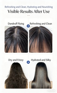 Champú Nutritivo, Aclarante e Hidratante de Uso Diario, Anticaspa, <span class=keywords><strong>Sin</strong></span> <span class=keywords><strong>Sulfatos</strong></span> ni <span class=keywords><strong>Siliconas</strong></span>, 300 ml, para Hombres Adultos - Product Image 4