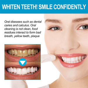 Poudre blanchissante pour les dents West Month au bicarbonate <span class=keywords><strong>de</strong></span> <span class=keywords><strong>soude</strong></span>, élimination des taches, éclaircissement, protection des gencives, élimination <span class=keywords><strong>de</strong></span> la mauvaise haleine - Product Image 6
