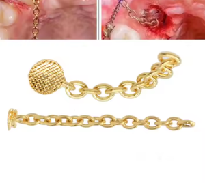 Orthodontische Linguale Keten, Goud En Zilver Orthodontische Accessoires, Tandheelkundige Verbruiksartikelen - Product Image 2