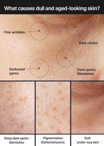 Crema Aclarante para Manchas Oscuras y Poros, con Niacinamida, Minimiza los Poros, No Irritante, 35 ml, Uso Nocturno, para Todo Tipo de Piel - Product Image 3