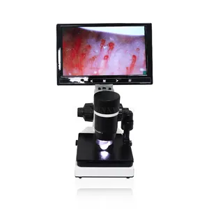 SY-b198 Professional Biological nail blood Electron Medical Capillary Diagnostic Equipment Blood Test Microscope