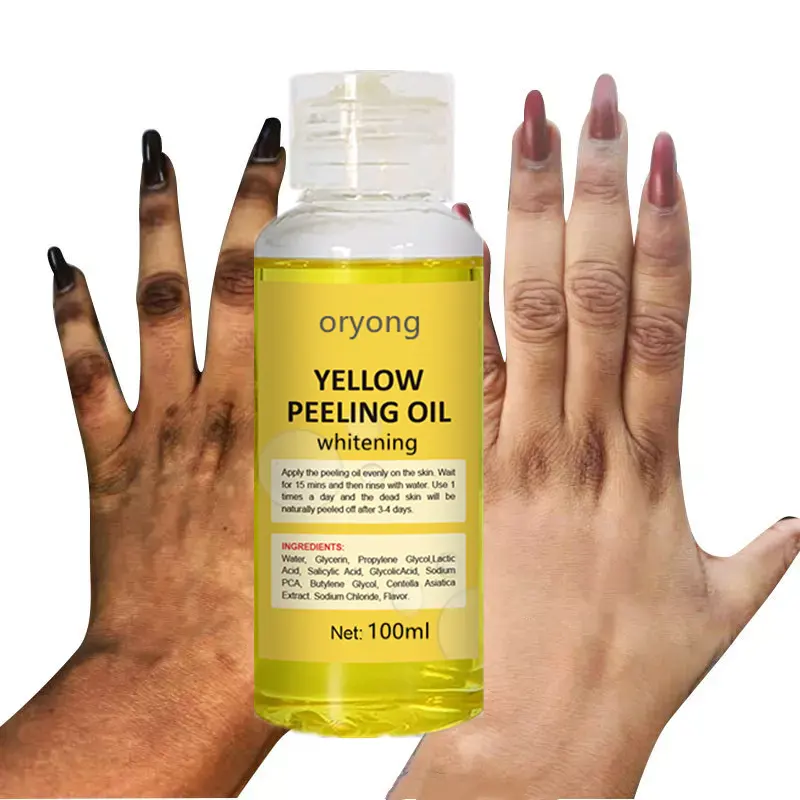 Soins de la peau cosmétiques produits de beauté plus efficace Super forte exfoliant pour le corps Lotion de soins de la peau huile de Peeling jaune
