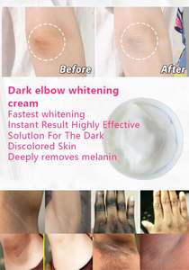 Crème éclaircissante pour la peau, vitamine C, éliminateur de taches brunes pour les aisselles, les genoux, les coudes et la ligne du bikini, crème éclaircissante pour la peau, cosmétiques de <span class=keywords><strong>plage</strong></span> - Product Image 2