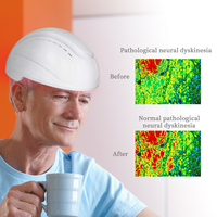 Casque de thérapie par lumière infrarouge neurique Suyzeko Professional Brain Neuron Stimulation 810nm 1070nm pour la brume cérébrale