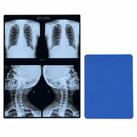 Film Inkjet Medis PET Basis Biru, Film Kering X-ray Transparan, Ukuran A4 A5 A6, Pasokan Grosir