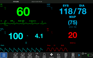 使いやすいタッチスクリーン不調分析獣医マルチパラメーターモニター - Product Image 6