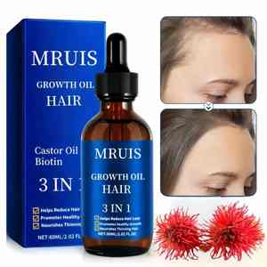 Aceite de ricino profundamente nutritivo para crecimiento rápido del cabello, aceite de ricino Natural orgánico para el cuidado de la barba, reparación de <span class=keywords><strong>pestañas</strong></span>, suero de aceite para el crecimiento del cabello para hombres y mujeres - Product Image 2