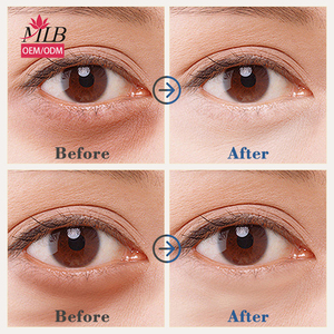 プライベートラベルナチュラルオーガニックスムースシワが明るくなり、アイローラーセラムの下でダークサークルカフェインアイセラムを減らします - Product Image 5