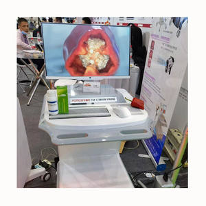 Colposcope électronique numérique pour diagnostic vidéo vaginal, caméra de colposcopie pour examen gynécologique - Product Image 3