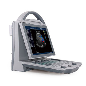 YSB-DU12V Geysendeerde Draagbare Veterinaire Echografie Kleur <span class=keywords><strong>Doppler</strong></span> Echografie Machine Dierenarts <span class=keywords><strong>3d</strong></span> 4d Gekleurde Veterinaire Echografie - Product Image 2