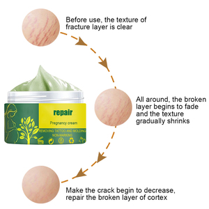 ครีมลบรอยแตกลายสำหรับการตั้งครรภ์ครีมลบรอยแผลเป็นผิวหย่อนคล้อยกระชับหน้าท้องไม่ระคายเคืองอ่อนโยนตามธรรมชาติ - Product Image 4