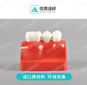 4 fois seul implant dentaire d'analyse modèle comparer avec pont logo OEM - Product Image 4