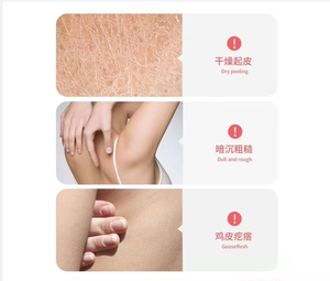 Sudáfrica Hot Rose Toner Surface Body Care Hidratante Iluminador Precio al por mayor 275ml - Product Image 5