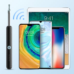 กล้องส่องตรวจหู,อุปกรณ์กำจัดขี้หูอัจฉริยะกล้องตรวจสอบ Otoscop Wifi ผลิตในจีน - Product Image 4