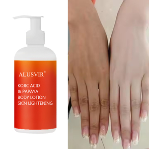 Nhãn Hiệu Riêng Kojic Axit Công Thức Tự Nhiên Hữu Cơ Đu Đủ Loại Bỏ Đốm Chăm Sóc Da Tẩy Trắng Làm Trắng Độ Ẩm Kem Dưỡng Da - Product Image 2