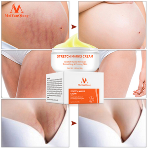 Logotipo personalizado etiqueta privada OEM marca de embarazo decoloración piel suavizante reafirmante estrías eliminación Crema para mujeres embarazadas - Product Image 2