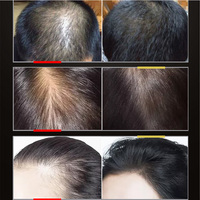 Produits phares OEM Personnalisé Meilleur sérum contre la perte de cheveux Sérum de croissance capillaire pour hommes Bloqueur de DHT Sérum de croissance capillaire