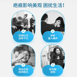 Solution réparatrice des cicatrices de tournesol, 30ml, pour les plaies postopératoires, les brûlures, les cicatrices hypertrophiques de section césarienne, dispositif médical de classe II - Product Image 4