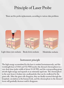 Appareil professionnel de suppression de tatouages pour salon de beauté 5-en-1 Picoseconde, équipement de nettoyage des pigments, des taches de rousseur et des sourcils, peeling au carbone - Product Image 4