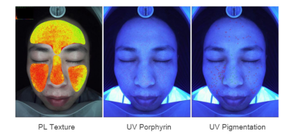 Analizador de Piel Facial 3D Profesional Portátil, Escáner de Diagnóstico de Piel para Medir la Humedad, Grasa y Poros, Equipo para Salón de Belleza - Product Image 5