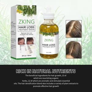 Sérum capillaire pour le soin du cuir chevelu, 100% naturel et biologique, à base d'huile essentielle de romarin, pour la croissance des cheveux, marque privée personnalisée, pour femmes - Product Image 3