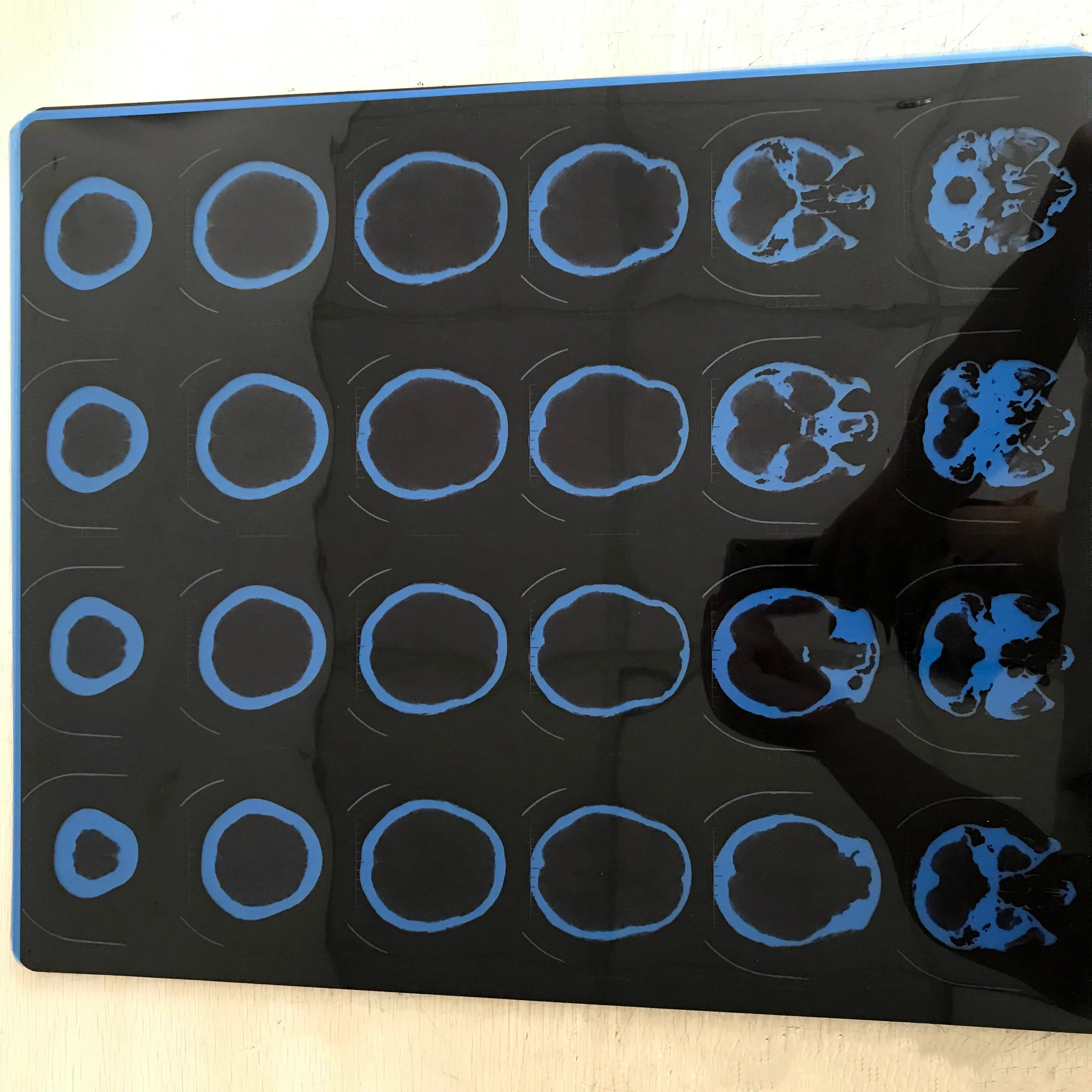 سعر المصنع عالية الدقة الأشعة السينية غشاء جاف يُستخدم في الأغراض الطبية لنظام DR فيلم الجافة الطبية صورة