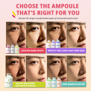 Ampolla Facial Iluminadora con Vitamina <span class=keywords><strong>C</strong></span> de Marca Privada, Suero Facial para un Brillo Máximo, Unifica el Tono de Piel, Esencia Blanqueadora, Fabricantes de Productos para el Cuidado de la Piel OEM - Product Image 4