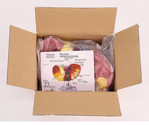 Modèle de foie en plastique PVC coloré Caractéristiques pathologiques cliniques communes Aide à la communication pour les médecins en hépatologie Gastroentérologie - Product Image 6