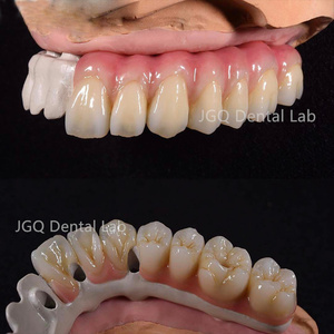 Prothèses dentaires sécurisées sur implant Ponts en zircone Arc complet Chine Laboratoire <span class=keywords><strong>dentaire</strong></span> <span class=keywords><strong>Prix</strong></span> compétitif - Product Image 3