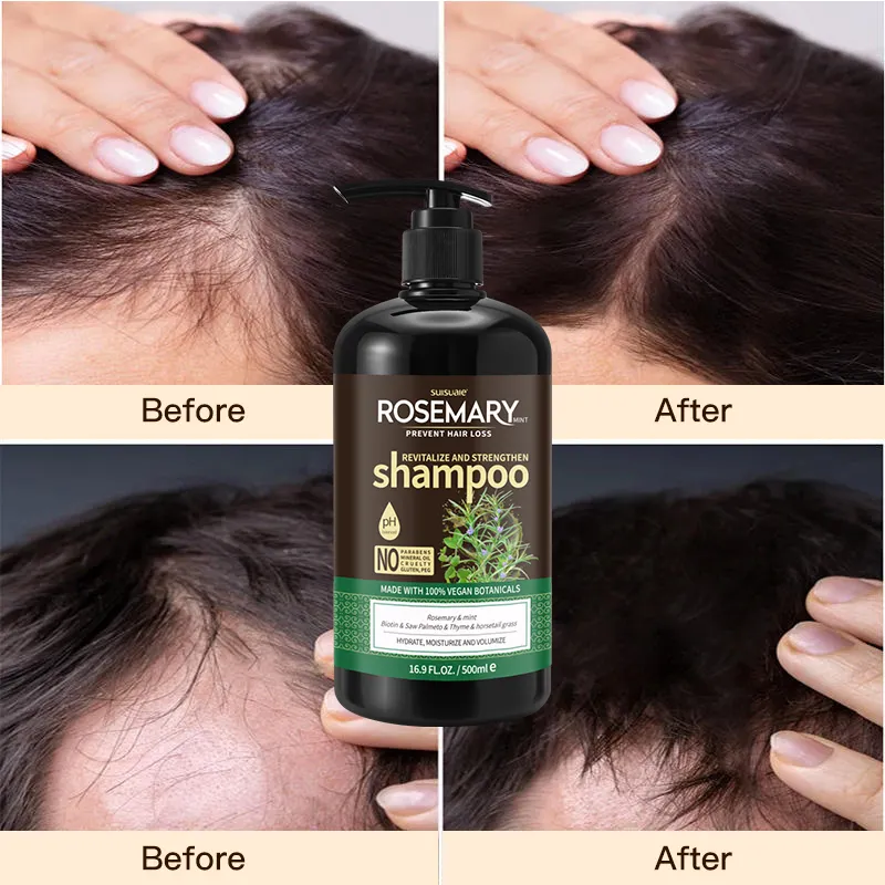 Usine OCCA Oem Ensemble shampooing et après-shampoing pour la croissance des cheveux à l'huile d'arbre à thé et romarin, organique et biologique, personnalisé et végétalien