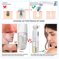 Extracteur de points noirs chauffant mini amélioré, nettoyeur de pores du visage, aspiration sous vide, éliminateur de points noirs