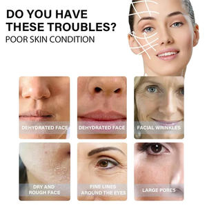 Suero Facial de Ácido Hialurónico para Lifting Instantáneo, Reparación Facial, Blanqueamiento, Reafirmación e Hidratación - Product Image 2