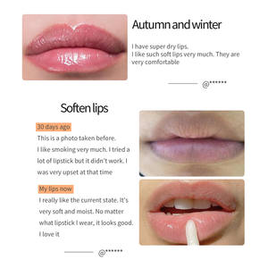 Gommage pour les lèvres au collagène, <span class=keywords><strong>masque</strong></span> pour les lèvres naturel, exfoliant, Turmeric, <span class=keywords><strong>miel</strong></span>, avec applicateur, marque privée, OEM - Product Image 3