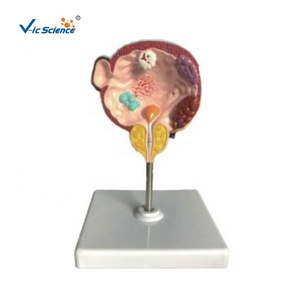 Enfermedades <span class=keywords><strong>de</strong></span> la vejiga y la próstata, modelo <span class=keywords><strong>de</strong></span> anatomía humana médica, patologías del sistema urinario masculino - Product Image 1