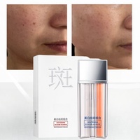 Produits OEM à forte demande Crème blanchissante pour le visage Dissolvant de taches de rousseur Éclaircissant pour la peau Niacinamide Effaceur de taches noires pour le visage