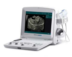 Máquina de Ultrasonido Veterinaria Edan DUS 60, Precio de la Máquina de Ultrasonido Veterinaria DUS60, Ultrasonido Portátil Veterinario en Blanco y Negro - Product Image 3