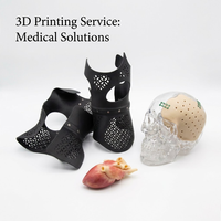 Impression 3D industrielle personnalisée, instruments de qualité médicale, pièces médicales imprimées en 3D SLA, services d'impression 3D