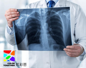 ฟิล์มเอ็กซ์เรย์สีน้ำเงินสำหรับการแพทย์แบบขายส่งระหว่างประเทศ พร้อมมุมโค้งมนและรอยบากสำหรับระบุข้อมูลด้านพิมพ์ - Product Image 1